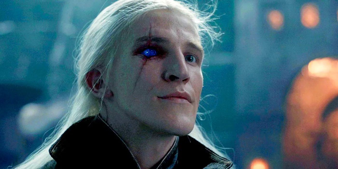 Ewan Mitchell as Prince Aemond defiantly showing his scarred and blinded eye in House of the Dragon season 1 Image