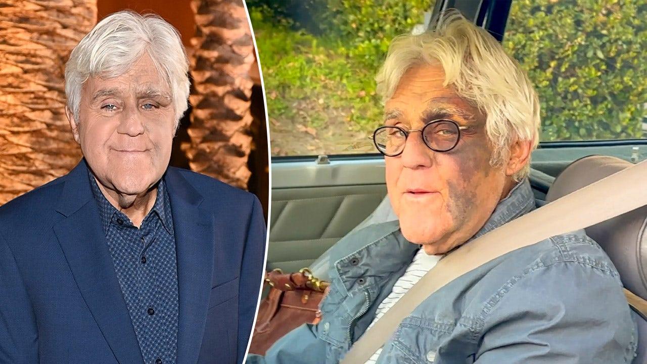 Jay Leno Injuries Explained: Motorcycle Crash, Fall, Face Burns & Mob Rumors image 3 